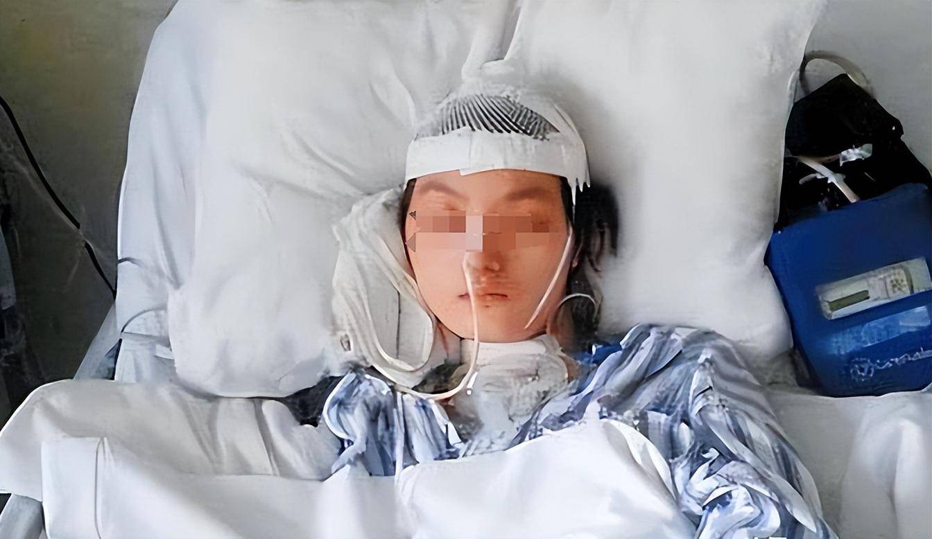 女子因佩戴鲨鱼夹意外摔倒导致重伤 陷入植物人状态的悲惨故事揭示危险性