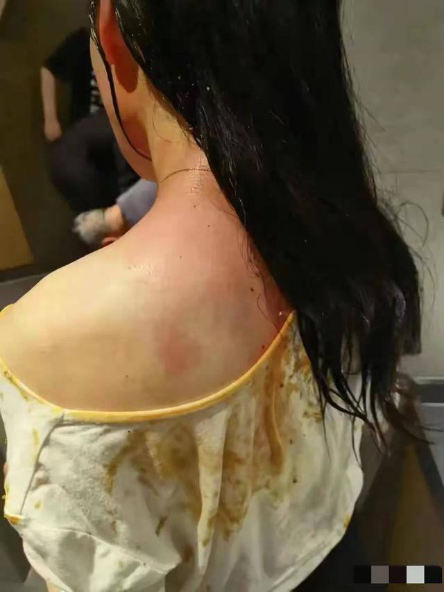 女子声称赌场讨债遭警方制止致三根肋骨骨折 警方最新情况引发热议