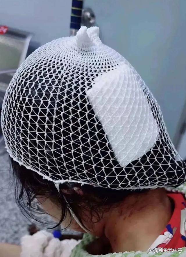 女子因佩戴鲨鱼夹意外跌倒后不幸昏迷 家人心碎盼奇迹出现