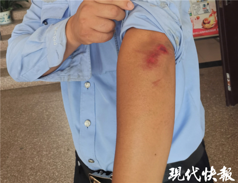 奋勇护儿童 辩护小朋友的辅警不幸遭遇狗咬伤的感人故事