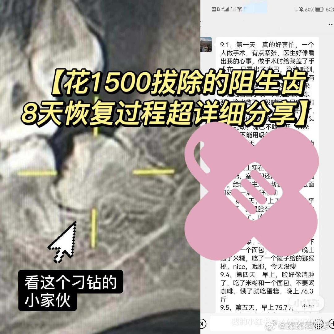 对飙车“炸街”，法律须长出“牙齿”