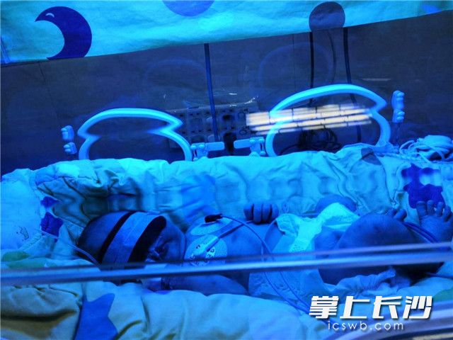 宜昌新生儿蓝光治疗突遭不幸 当地卫健局迅速组建专门团队开展深入调查