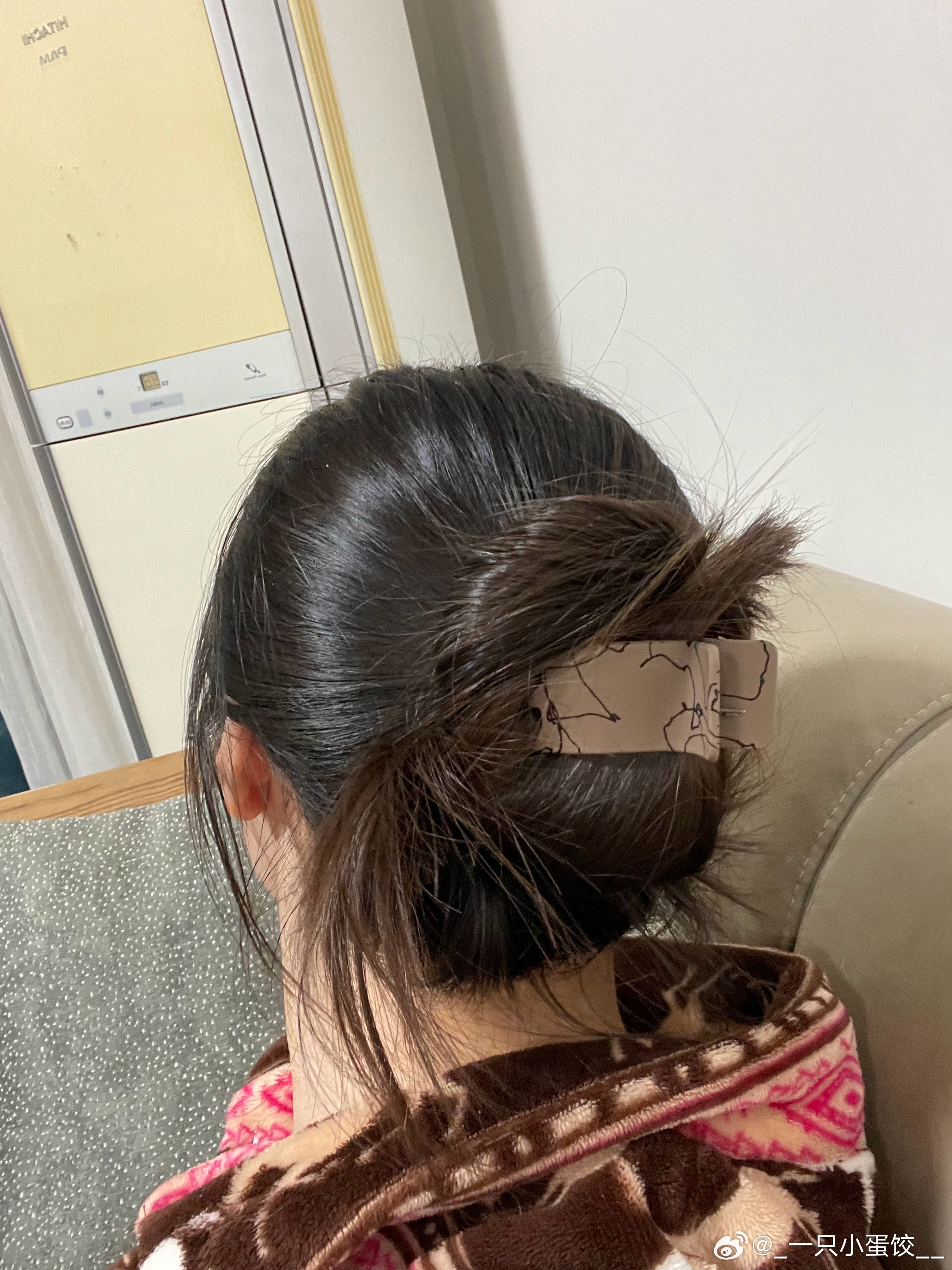 女子因佩戴鲨鱼夹意外跌倒后不幸昏迷 家人心碎盼奇迹出现