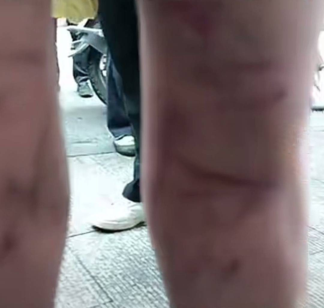 重庆警方公布两名男孩遭虐待事件详情生父已被依法采取刑事措施处理