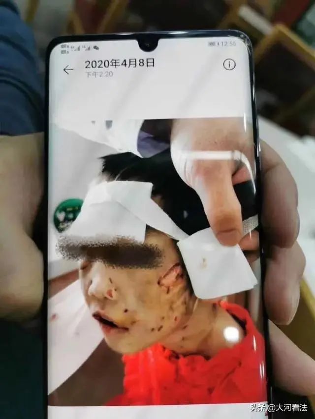 重庆警方公布两名男孩遭虐待事件详情生父已被依法采取刑事措施处理